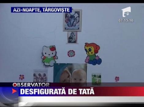 Desfigurata de tata