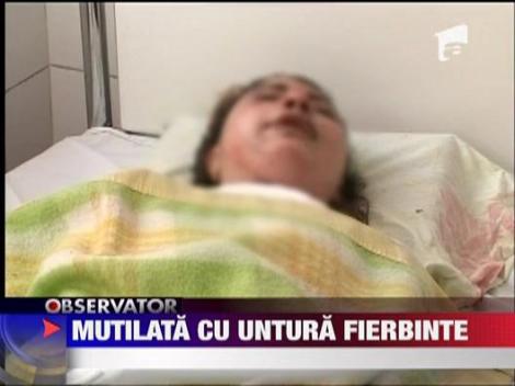 Mutilata cu untura fierbinte