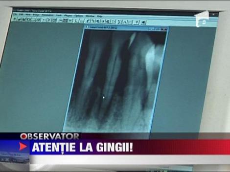 Principalele simptome ale paradontozei