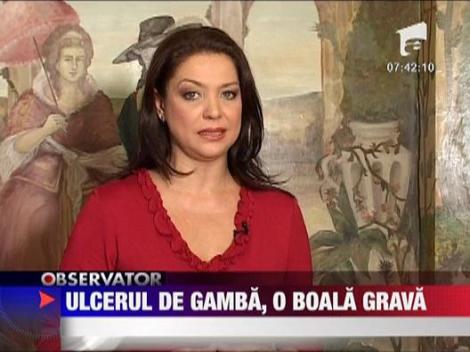 Felicia: Ulcerul de gamba, o boala grava