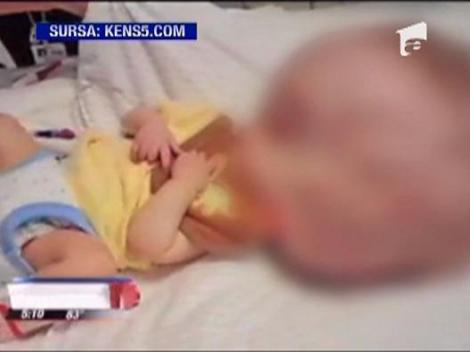 IMAGINI SOCANTE! Bebelus nascut cu un cap gigantic