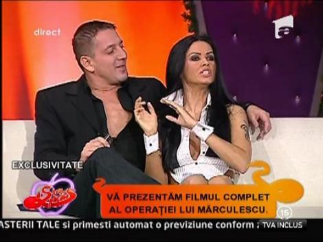 Marculescu si-a facut operatie de lipoabsorbtie!