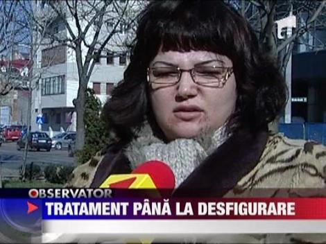 Soprana Ozana Barabancea, desfigurata de injectiile pentru hidratarea pielii