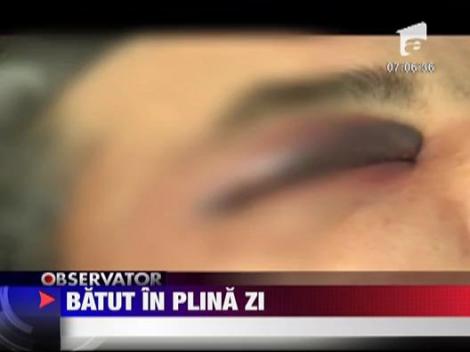 Batut in plina zi, cu bate de baseball