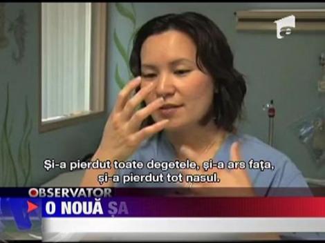 O noua sansa la viata, dupa un incendiu care l-a mutilat