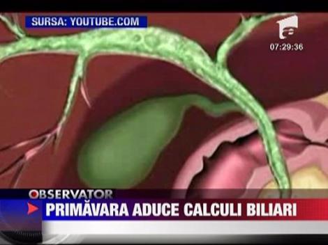 Primavara aduce calculi biliari