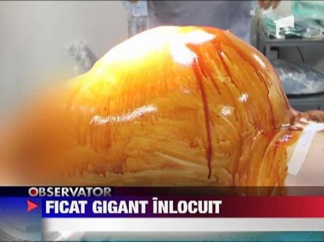 Transplant de Cartea Recordurilor la Spitalul Fundeni