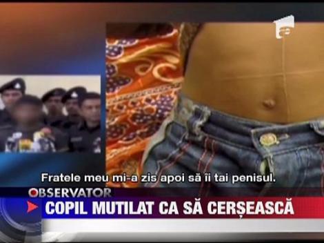 IMAGINI SOCANTE! Copil mutilat pentru ca a refuzat sa cerseasca