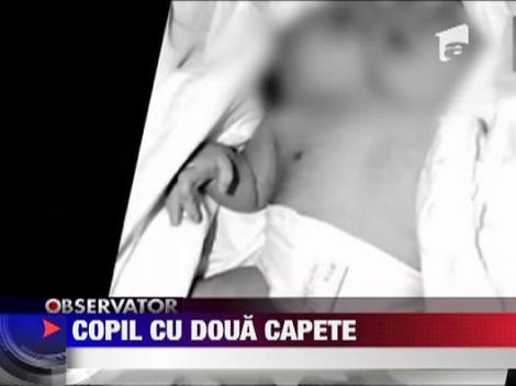 Socant: Copil cu doua capete in China