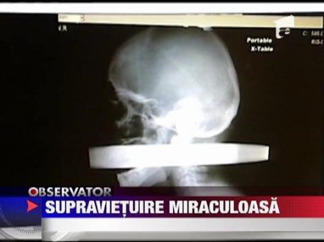 Un american a supravietuit dupa ce o teava metalica i-a strapuns capul