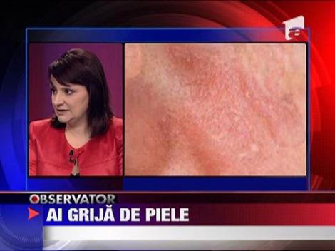 Sanatate: Dermatita atopica