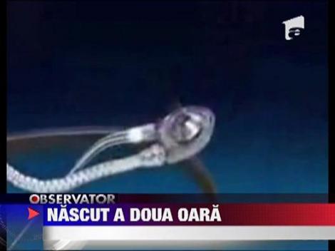 Primul roman cu inima artificiala