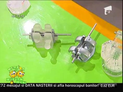 Prevenirea si tratamentul precoce al anomaliilor dento-maxilare