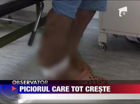 Picior de om ca de elefant!