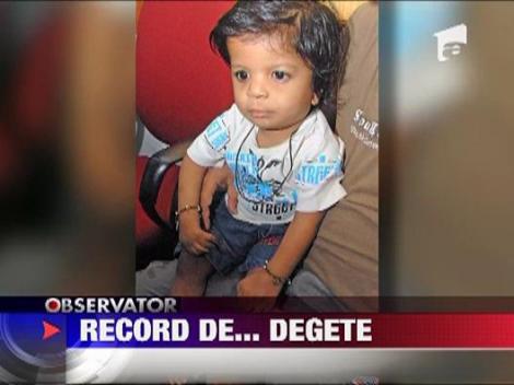 Un baiat din India s-a nascut cu 34 de degete!