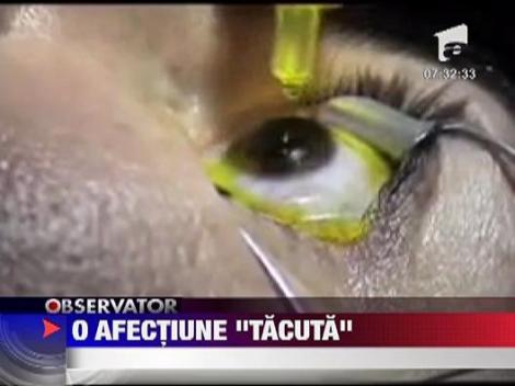 Sanatate: Keratoconul, boala tacuta a ochiului