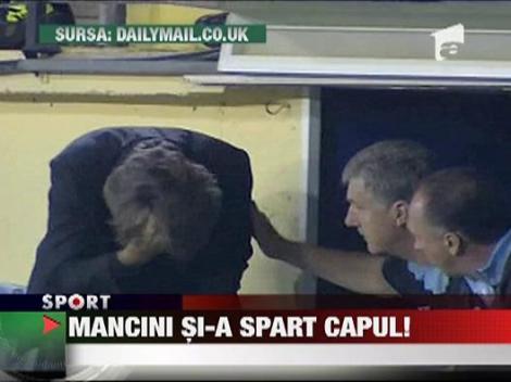 Mancini si-a spart capul