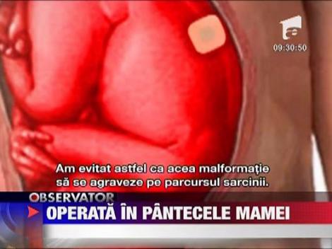 Fetita romanca operata in Spania in pantecele mamei