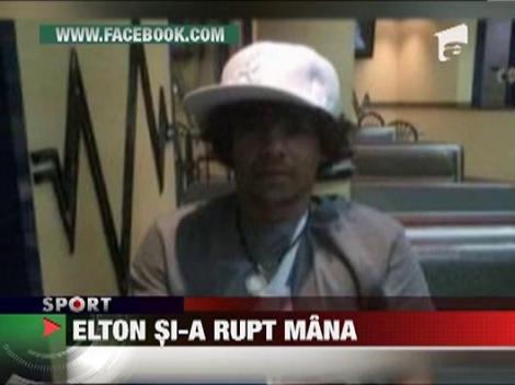 Fostul stelist Elton si-a rupt mana