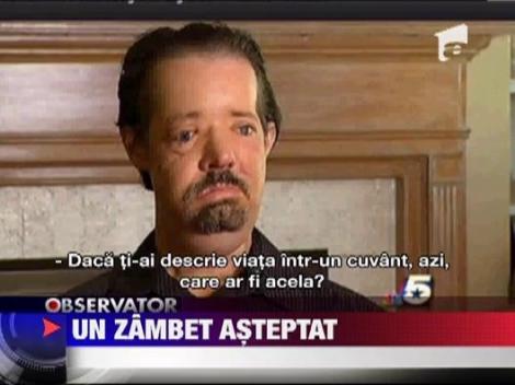 Primul american care a suferit un transplant total de fata