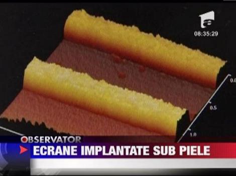 Ecran implantat sub piele