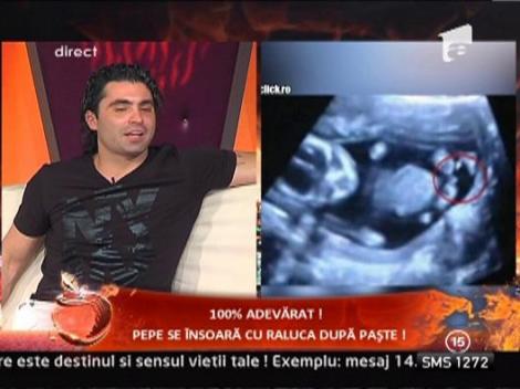 Ecografia copilului lui Pepe