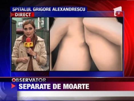 Una dintre siamezele nascute anul trecut, de Craciun, la Pitesti, a murit