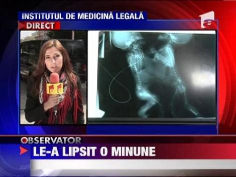 Parintii siamezelor se pregatesc de inmormantare