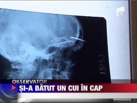 Un detinut si-a batut un cui in cap