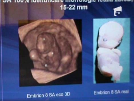 Carmen Bejan e inca in spital