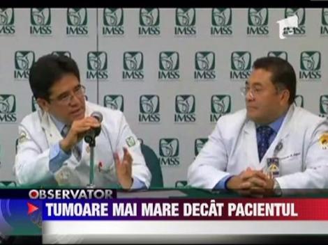 Tumoare mai mare ca pacientul
