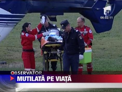 Gorj: O fetita de 4 ani si-a prins mana intr-o masina de tocat carne