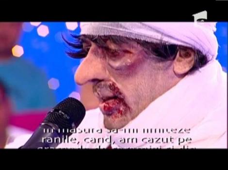 Vezi cum a interpretat CRBL monologul muncitorului ranit!