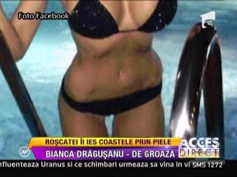 Bianca Dragusanu, numai piele si os