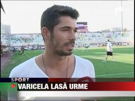 Ovidiu Herea a ramas cu semne, dupa ce s-a vindecat de varicela