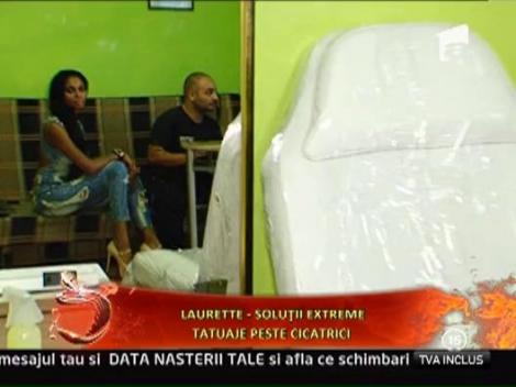 Laurette isi face tatuaje peste cicatrici