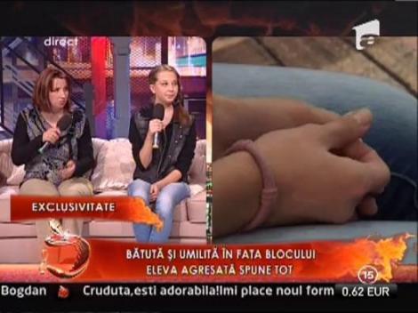 Eleva batuta cu bestialitate rupe tacerea! Aflati toate amanuntele episodului violent