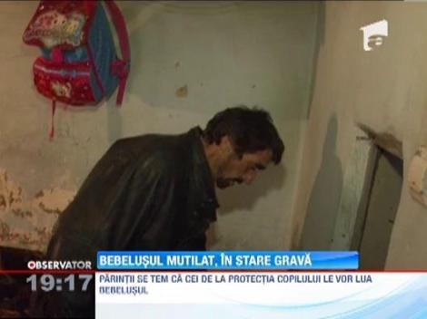 Bebelusul mutilat de sobolani e in continuare la terapie intensiva