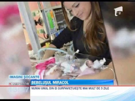 IMAGINI SOCANTE! Fetita care s-a nascut cu inima in afara pieptului, operata cu succes