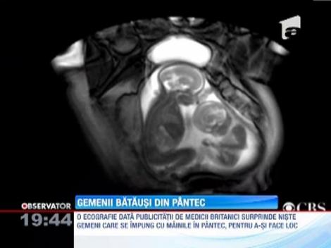 Ecografie din pantecele unei viitoare mame de gemeni