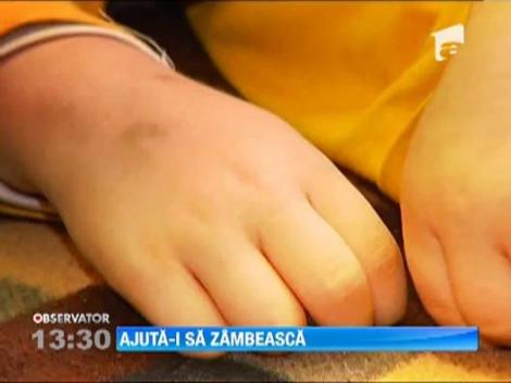 Campanie "Ajuta-i sa zambeasca!" Andrei si-a petrecut aproape jumatate din viata intre doctori si asistente