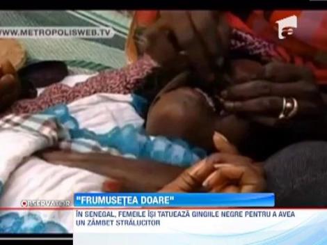 Tratament de infrumusetare socant in Senegal: Femeile isi tatueaza gingiile