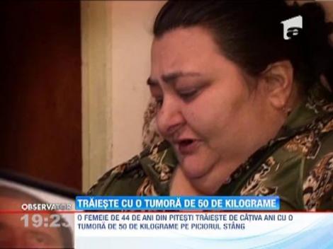 Socant: O femeie din Pitesti traieste de ani buni cu o tumora de 50 de kilograme pe piciorul stang