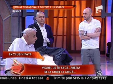 Viorel Lis isi face implant de par! Vezi aici cum ii sta