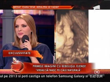 Elena Hueanu: "Vreau sa nasc pe cale naturala"