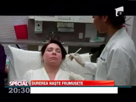 Procedura de intinerire dureroasa, dar eficienta! Medicii pot indeparta zece ani de pe figura pacientului