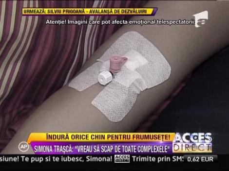 Simona Trasca: "Vreau sa scap de toate complexele"