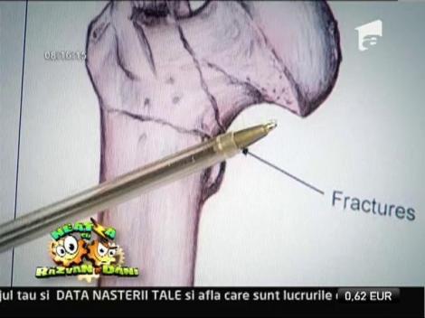 Osteoporoza, boala care afecteaza si barbatii