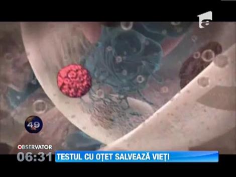 Test cu otet pentru depistarea cancerului cervical