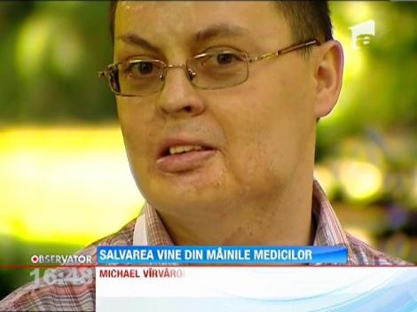 Salvarea vine din mainile medicilor! Michael a fost ars pe aproape jumatate din suprafata corpului